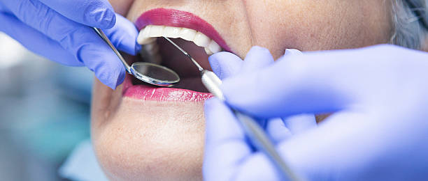 Best Emergency Wisdom Tooth Extraction in Rodney Village, DE
